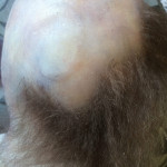 Baby head hair punching